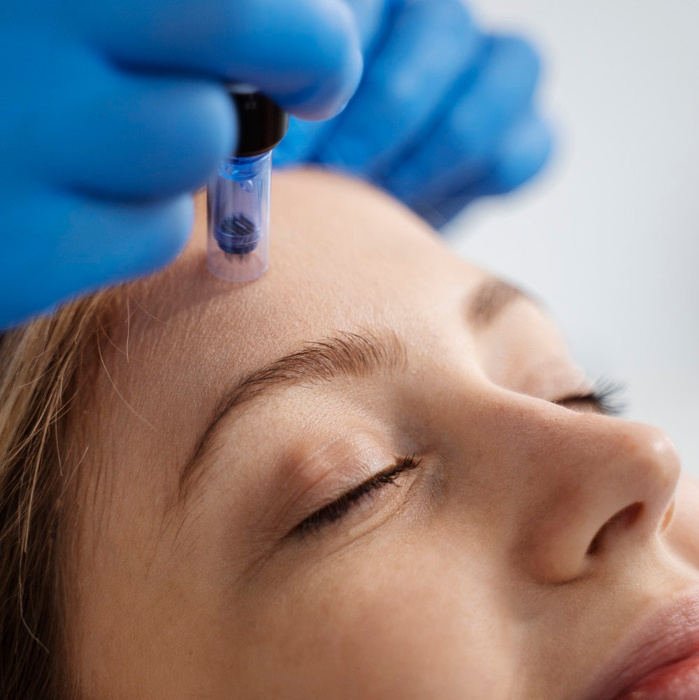 Collagen Induction / Microneedling (60 minutes)